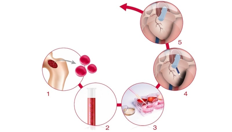 celyad_cardiopoiesis_c-cure_chart1