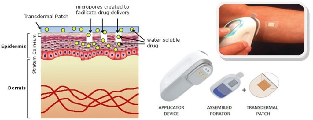 nitto_transdermal_drug_delivery_skin_patches_diabetes_medtech-diabetes_review