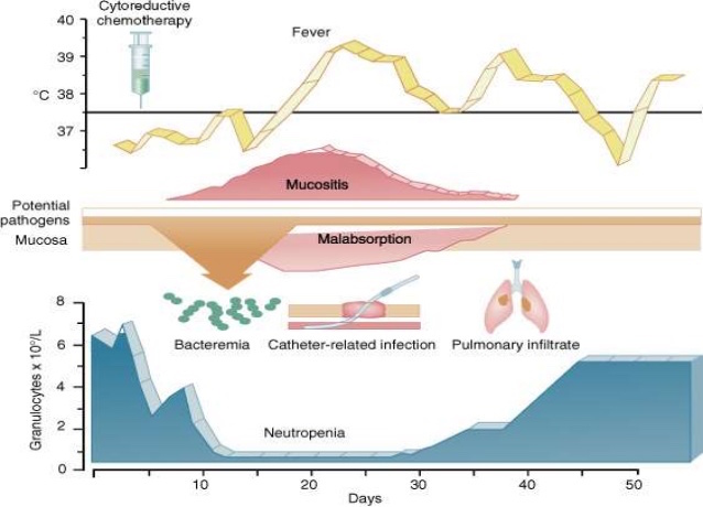 Cinfa neutropenia chemotherapy biotech cancer biosimilar