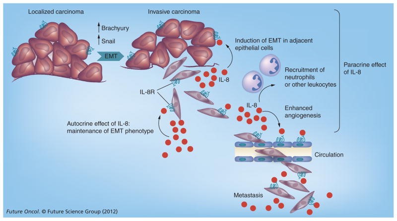 cormorant humax-il8 interleukin 8 metastatic cancer