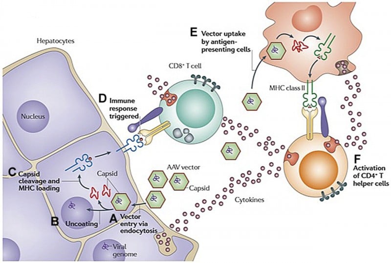 gene therapy aav liver hemophilia