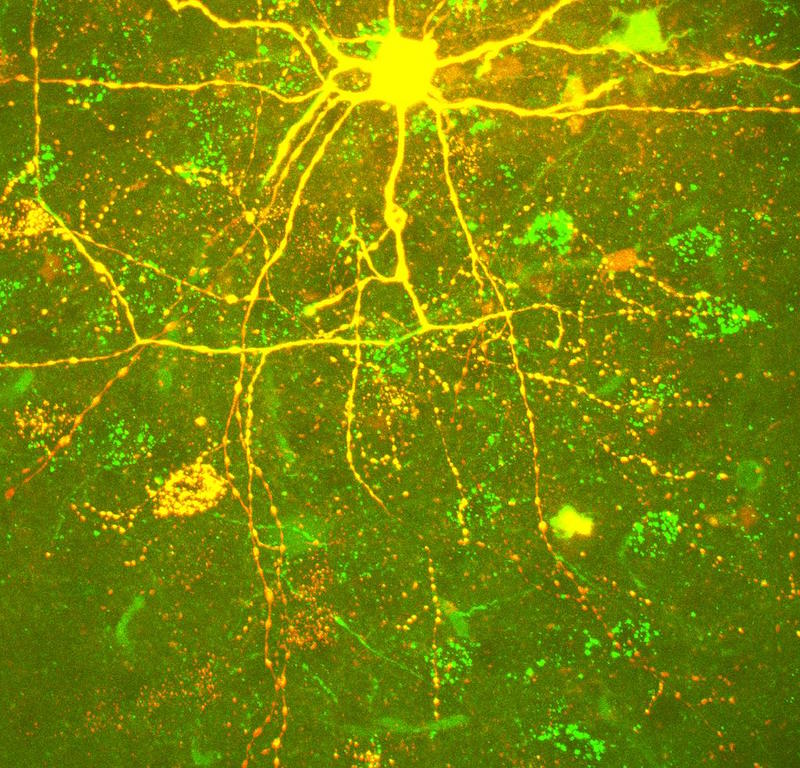 Figure 1. Multiple sclerosis is an autoimmune disease characterised by the destruction of myelin sheaths. Neurons, like the one shown here, needs these proteins for the transmission of their electrical signals.