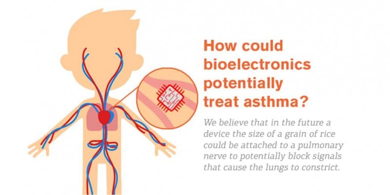 bioelectronic medicine electraceuticals asthma galvani