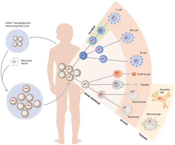 gene therapy cd34 stem cells strimvelis