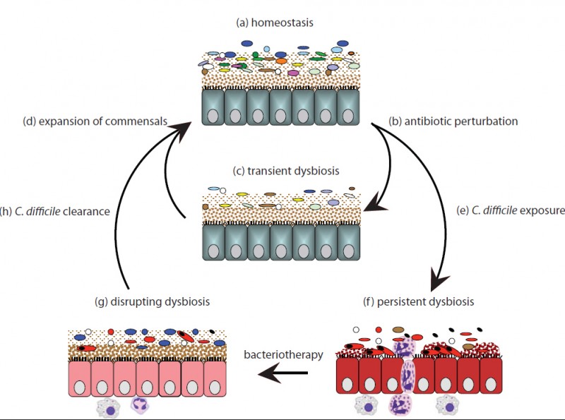 microbiome therapy clostridium difficile infection