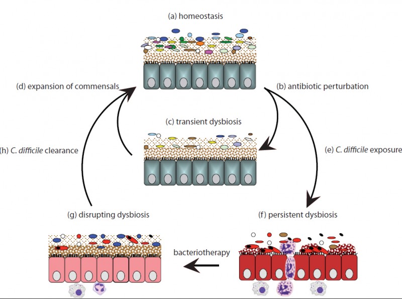 microbiome therapy clostridium difficile infection