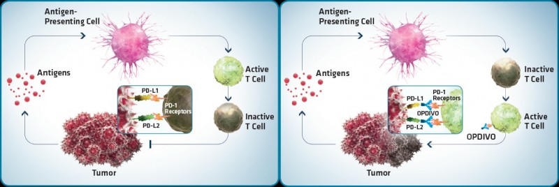 opdivo anti-pd-1 checkpoing inhibitor bms