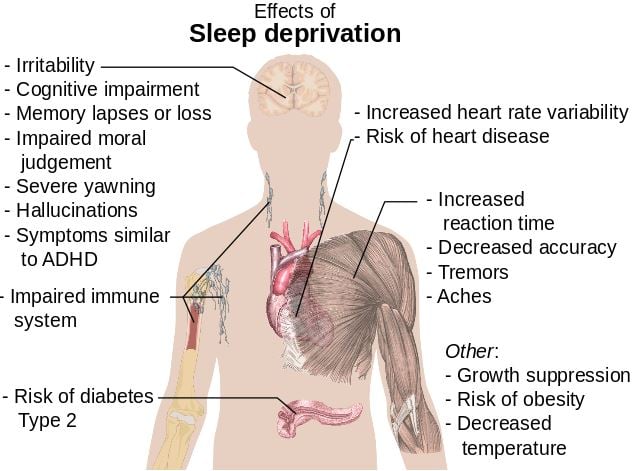 sleep disorders insomnia research neurology