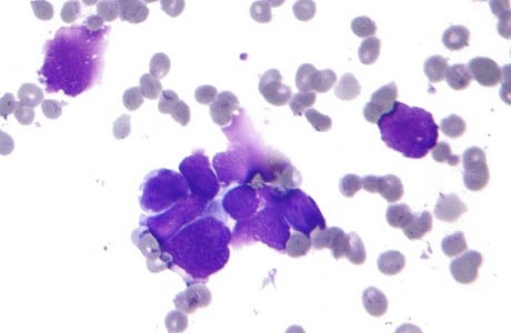 small cell lung cancer pharmamar