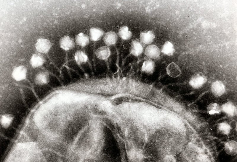 Figure 2. Bacteriophages attacking a bacterial cell.