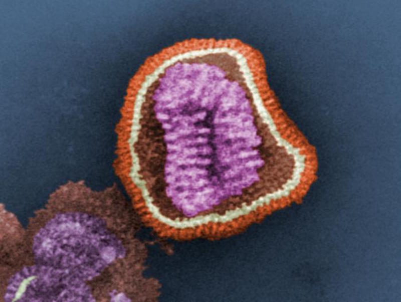 Figure 1. This influenza virus could be the target of Rigontec's new RNA-based therapy.