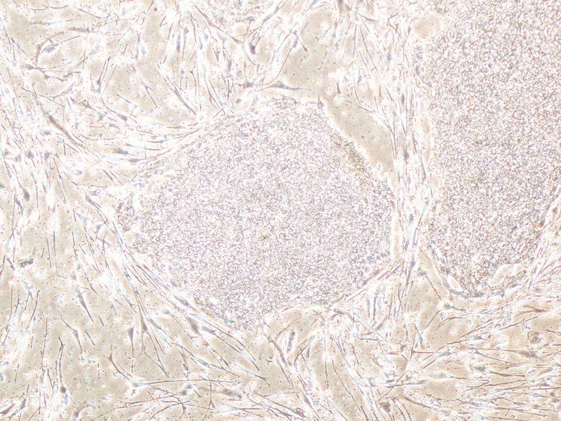 Figure 1. Mouse embryonic stem cells: as a direct consequence of some countries' lax regulations, these could end up in your implant!