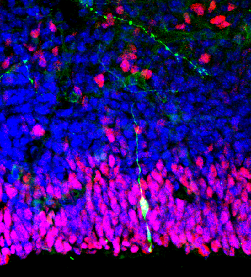 Figure 2. Neural Stem Cells were the subject of Italy's Stamina debacle.