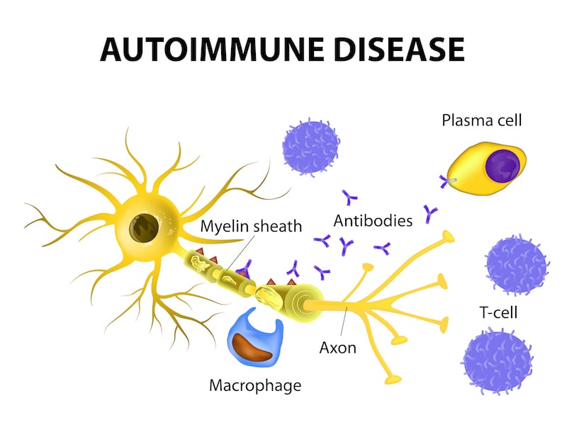 Figure 1. The mechanism of multiple sclerosis