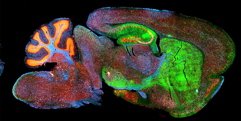 Figure 1. The brain of a mouse with a <a class=