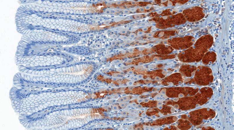 Figure 1. Enzymes in stomach glands.