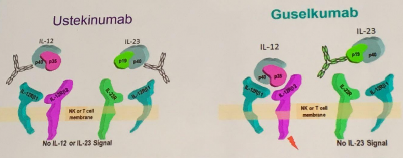 ustekinumab vs guselkumab to treat psoriasis