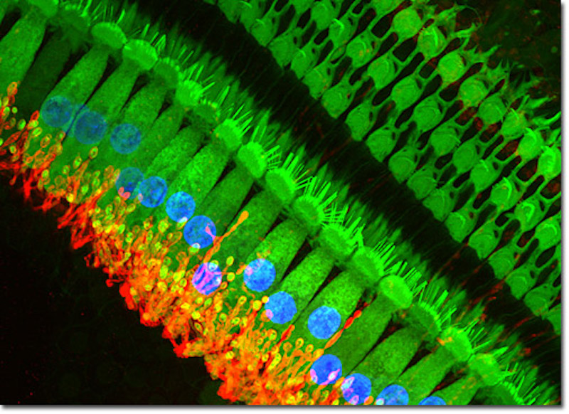 art-cochlea-picture