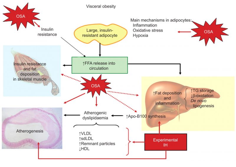 visceral fat phisiology metabolism liver