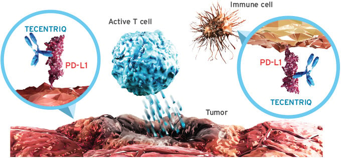 Roche Tecentriq PD-L1 cancer Medical Biotechnology