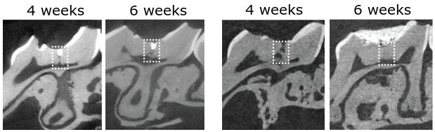 Kings College London Tooth Regeneration