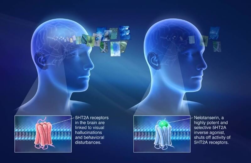 Nelotanserin axovant sciences dementia