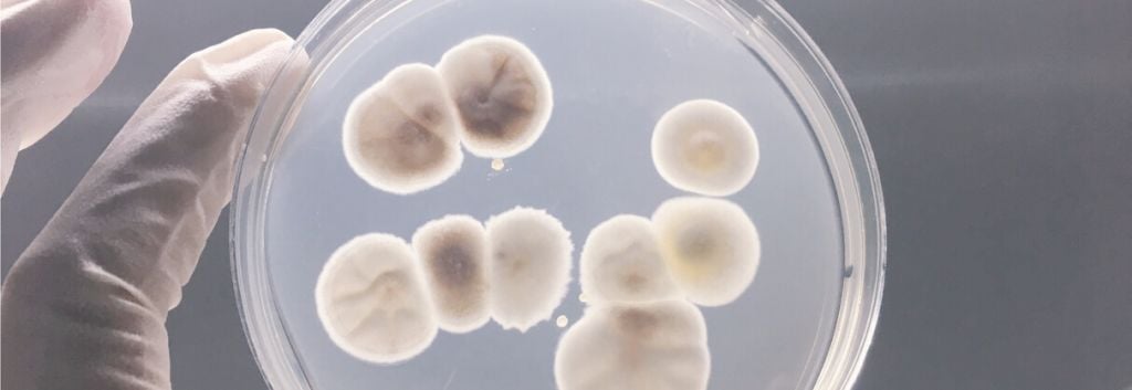 Roche Discuva Bacterial Resistance