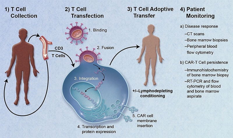 800px-CAR-Engineered_T-Cell_Adoptive_Transfer
