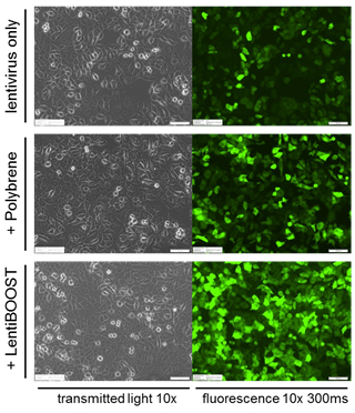 Sirion Biotech lentiboost stem cell therapy