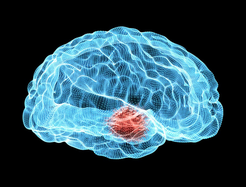 Newron Parkinsons FDA approval xadago