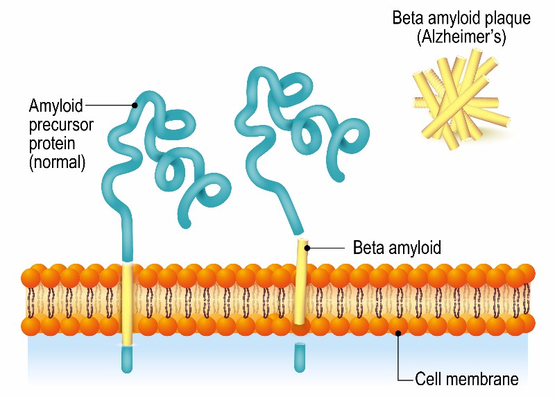 roche morphosys alzheimers antibody gantenerumab