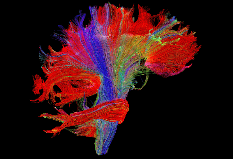 Neuroimaging DIMA Neuroaesthetic Project Pathways