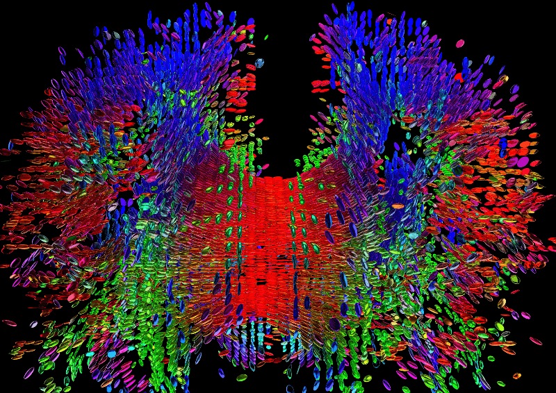 Neuroimaging DiMa NeuroAesthetic Project the brain in cubes