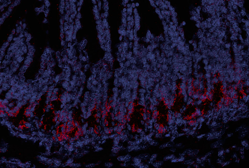 Intestinal Epithelium_GVHD