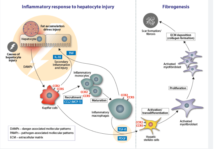 NASH_Inflammatory-Mechanisms