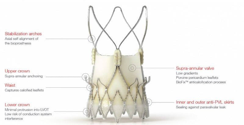 Symetis_neovalve