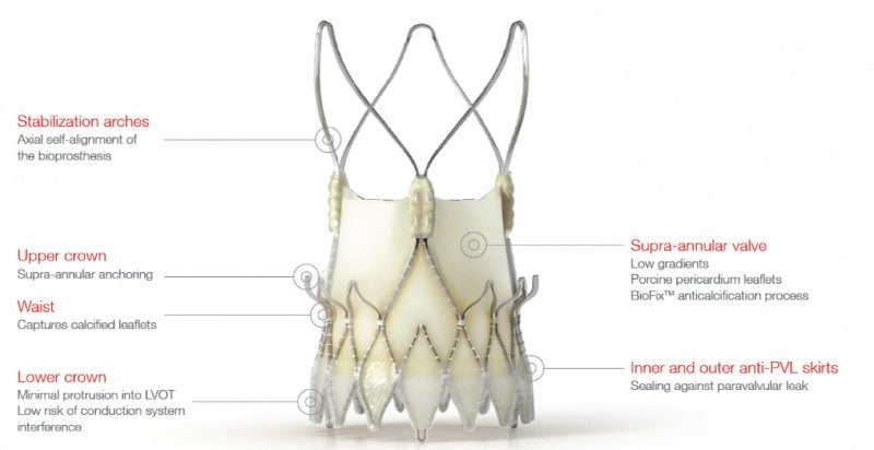 Symetis_neovalve