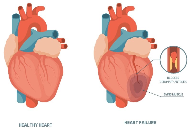 Cardior Pharmaceuticals fundraising heart failure