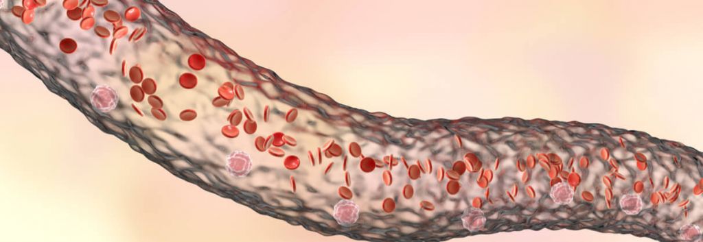 Cinfa Biotech biosimilar amgen