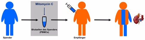 Tolerogenixx cell therapy transplant - Edited