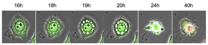 institut pasteur zika research