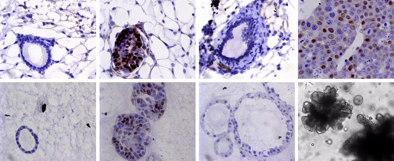 EMBL scientists used mice (top) and organoids (bottom) in which they could induce tumours (2nd column), mimic perfect treatment and study minimal residual disease (3rd column), and analyse tumour recurrence (4th column)