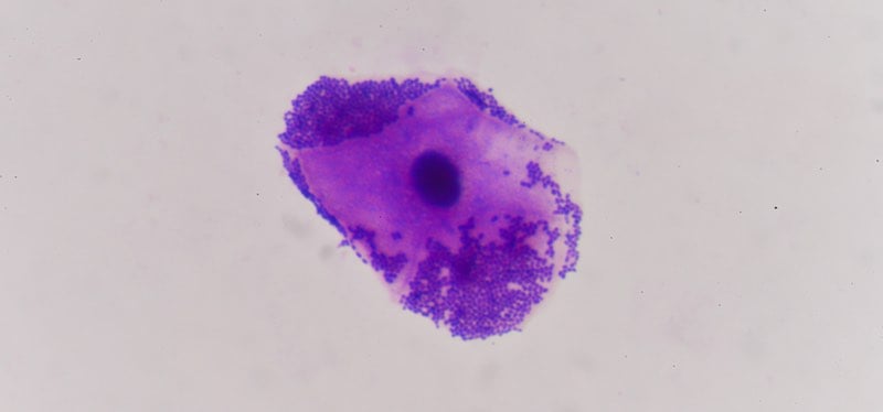 Gram staining