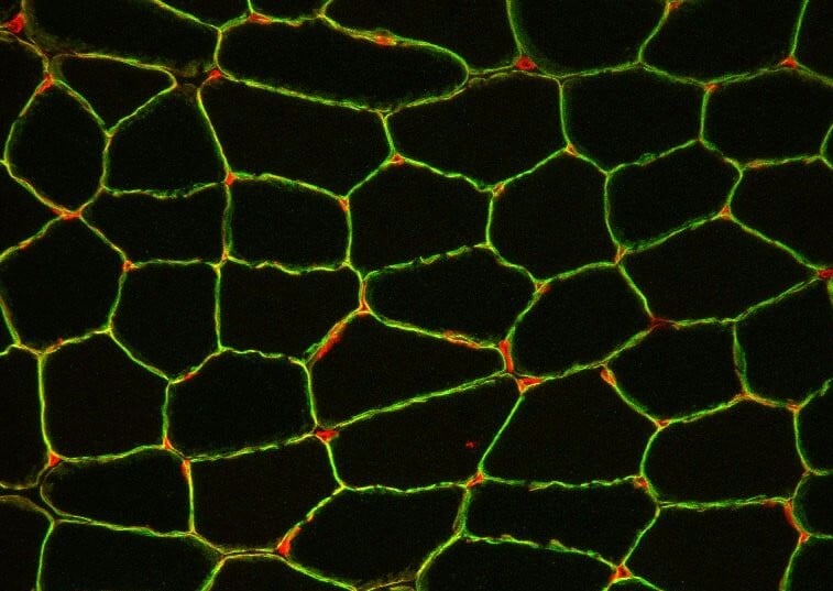 Basel University muscular dystrophy laminin