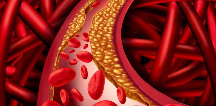 Novartis Cardiovascular Canakinumab Phase III