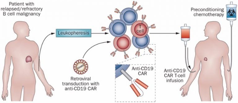 CAR-T-therapy-review-CD19-antigen-1-768x334