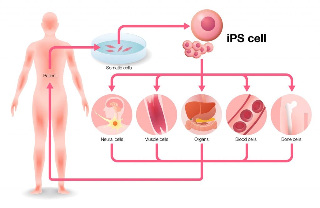 induced-pluripotent-stem-cells-evotec