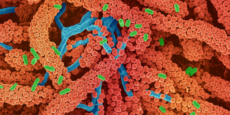 metformin in | Diabetic lifestyle, Type 1 diabetes, Certified diabetes educator