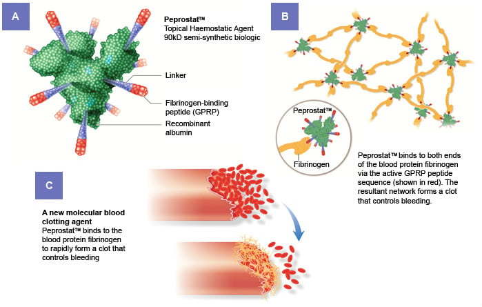 Ergomed PeproStat Surgery