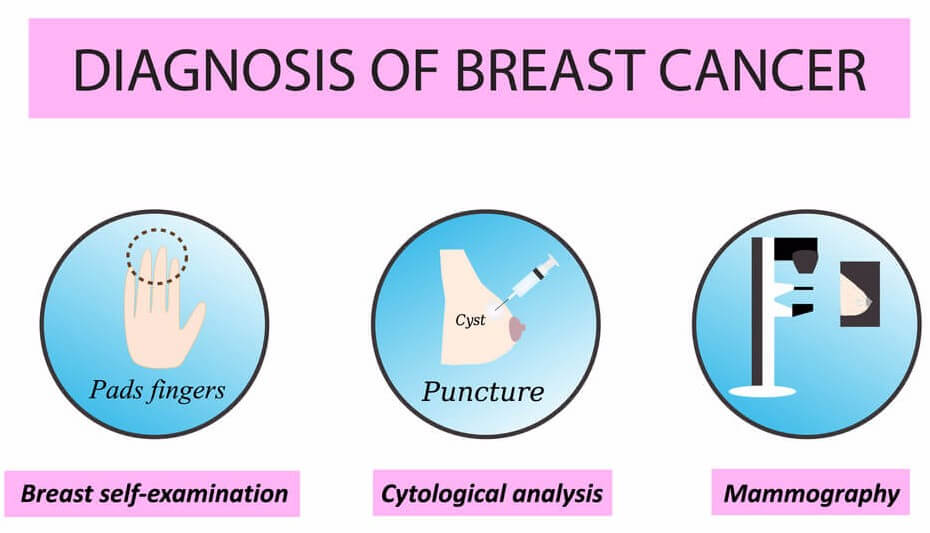 Personalized Breast Cancer Treatment Coming with Help from Inbiomotion